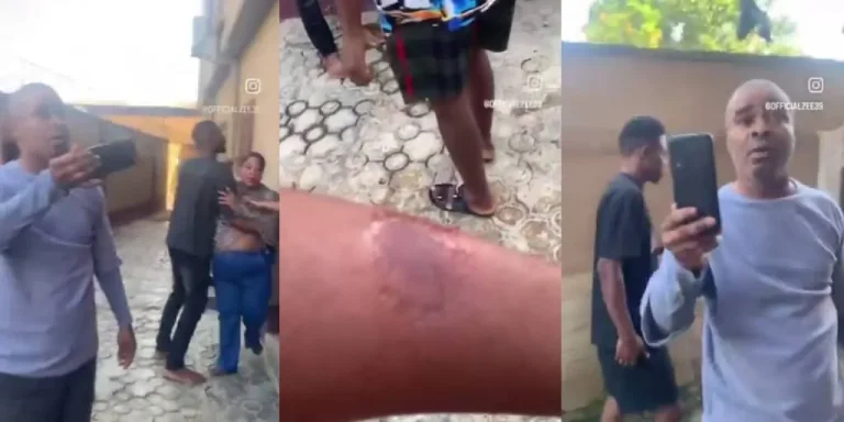 Read more about the article Landlady Bites Tenant In Heated Clash